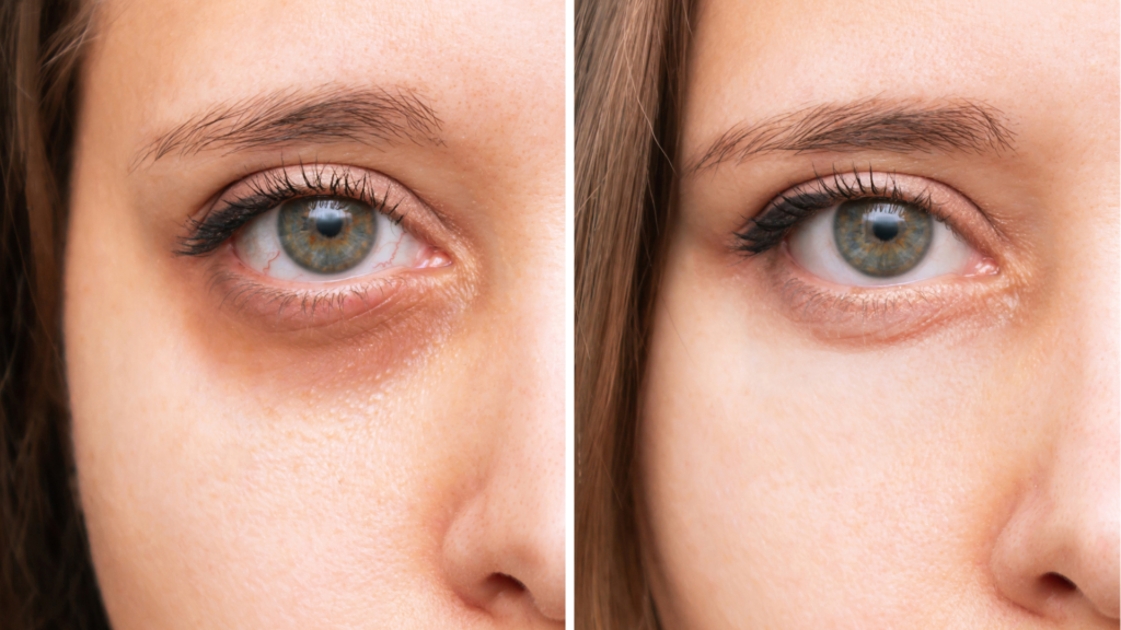 Die Wirkung von jalupro young eye: MorySkin erklärt Vorteile für Augenpartien